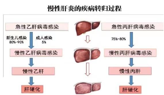 【健康科普】世界肝炎日——堅持早預防，加強檢測發(fā)現(xiàn)，規(guī)范抗病毒治療